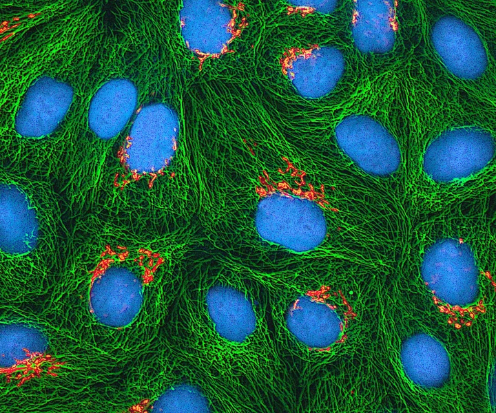 Multiphoton fluorescence micrograph of cultured HeLa cells with green microtubules, orange Golgi regions and cyan DNA.