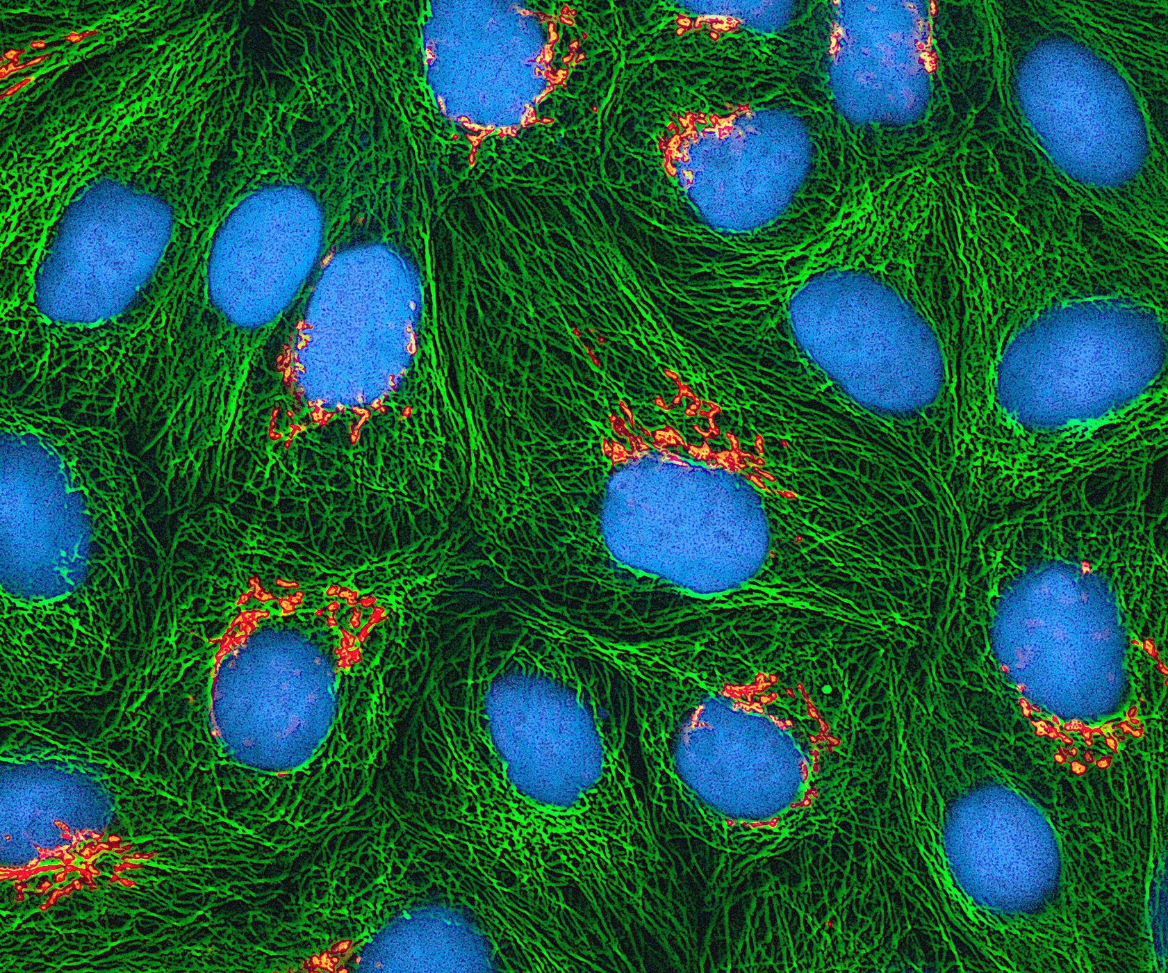 Multiphoton fluorescence micrograph of cultured HeLa cells with green microtubules, orange Golgi regions and cyan DNA.