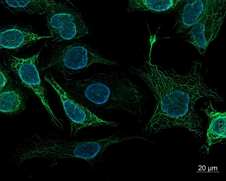 Fluorescence micrograph of human-derived cells with green vimentin filaments and blue-stained nuclei.